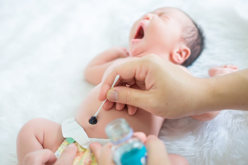 perawatan bayi baru lahir